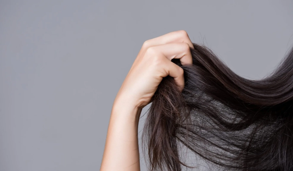 Causes-of-Hair-Loss-and-Best-Treatments-for-This-2038x1146